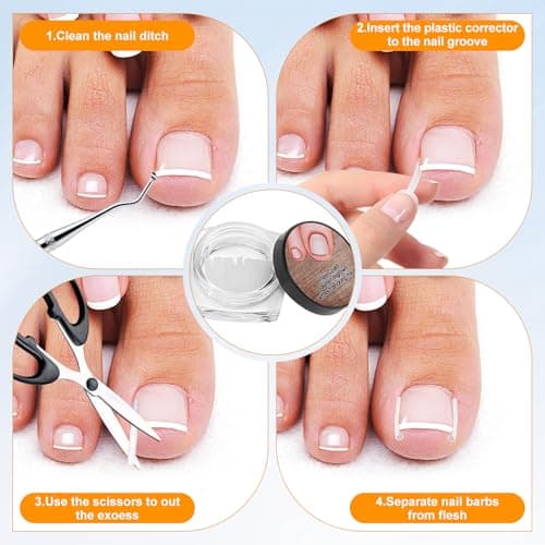 Ingrown Toenail Corrector Set with Correction Strips, Ingrown Toenail Removal Kit, Professional Ingrown Toenails Pedicure Tool Set (Silver) - Thumbnail 5