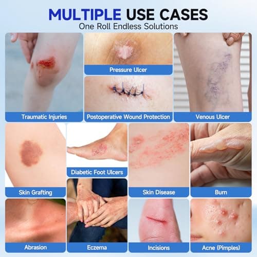 Hydrocolloid Roll for Wound Care - Medical Grade Self-Adhesive Gel Bandages, Ultra Absorbent & Waterproof Bandage, DIY Cut-to-Size First Aid Supply (2in×10ft) - Thumbnail 3
