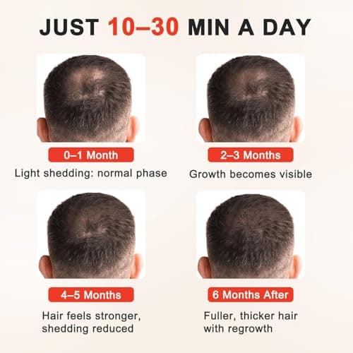 Red Light Therapy for Hair Growth for Men & Women,Red Light Hair Growth Cap,Full-Scalp Coverage,At-Home Scalp Care, Father‘s Day Gift Idea,Blue Cap - Thumbnail 2