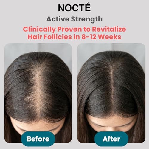Hair Regrowth Serum Spray - Minoxidil 5% Advanced Rosemary, Biotin with Caffeine, Botanical Extract for Thicker, Fuller, Longer Hair, Reduces Hair Thinning, Hair Loss Treatment for Men & Women - 60 ML - Thumbnail 3