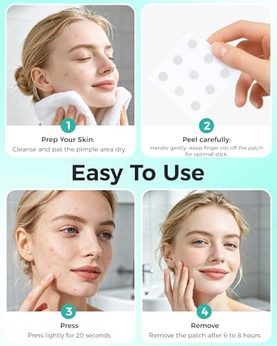 Pimple Patches for Face, 36ct Microdart Acne Patches, Microdart Pimple Stickers for Covering Zits & Blemishes, Self-Dissolving Microneedle Patches with Salicylic Acid, Hydrocolloid Facial Patches - Thumbnail 5