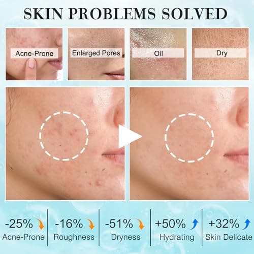 Teen Women Gifts,Skin Care,Skincare,Hydrate,Oil Control,Pore Shrinking,Anti-Allergy Facial Skin Care Routine Kit Travel Size Gift Set Stocking Stuffers for Teen Girls 10-12 16-18 & Women for All Skin - Thumbnail 3