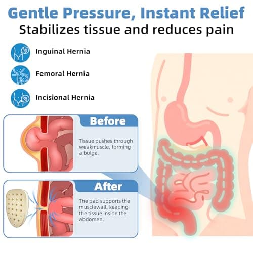 Tenbon Hernia Belts for Men and Women Left or Right Side Hernia Support Truss for Inguinal Groin Pain with Removable Compression Pads for Pref or Post-Surgical, Femoral, Comfortable Adjustable Waist Strap Guard - Thumbnail 2