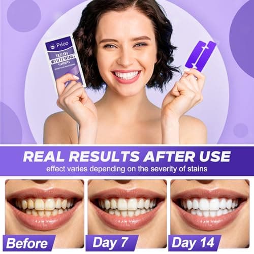 Purple Teeth Whitening Strips - 20 Teeth Whitener Strips (10 Uses) | Purple Color-Correcting Gel Technology | Teeth Whitening Kit for Sensitive Teeth | Enamel Safe, Peroxide-Free for a Brighter Smile - Thumbnail 4