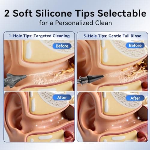 Berrcom Ear Wax Removal Kit with Sanitizing Mode & 6 Nozzles - Upgraded Electric Ear Cleaner and Irrigation System, 3 Pressure Settings, One-Piece Tank, IPX7 Waterproof, USB-C - Thumbnail 4