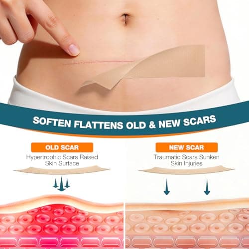 Silicone Scar Sheets,Silicone Scar Tape, Professional Scar Removal, Silicone Scar strips for Surgical scars tape, C-Section,Tummy Tuck (1.6x11859''Roll-3.0M) Keloid bump removal - Thumbnail 3
