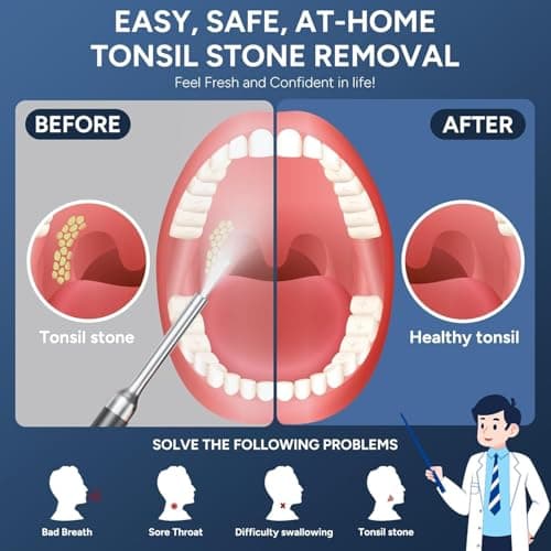 Tonsil Stone Remover with Camera - Upgraded Visual Tonsil Stone Removal Kit with 6 LED Light -Tonsil Stone Remover Tool with 1080P Camera, 5 Stainless Steel Heads, Irrigator,for iOS & Android (Black) - Thumbnail 2