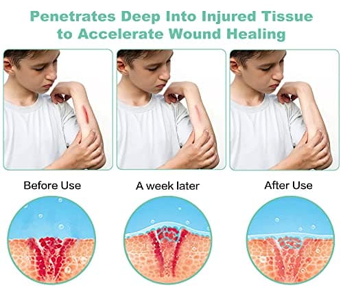 Red Light Therapy, Portable Powerful Red Infrared Light Therapy Device w/5 LEDs 5 Wavelengths, ASWAYSUN Blue Light Healing Therapy Torch for Body Knee Hand Muscle Joint Pain Relief Near Infrared Light - Thumbnail 2