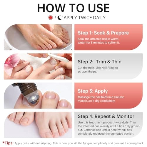 Nail Fungus Treatment Extra Strength – 1% Tolnaftate, Effective Treatment Under and Around Nails, Repairs Damaged Nails, Plant-Based Gentle Formula for Thickened and Discolored Nails, 0.51 fl.oz - Thumbnail 6