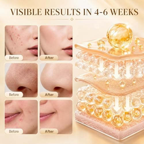 Turmeric Kojic Acid Cleansing Pads For Face, 60 Pcs Kojic Acid And Turmeric Cleansing Pads For Exfoliation, Turmeric Pads For Face Cleansing - Thumbnail 5