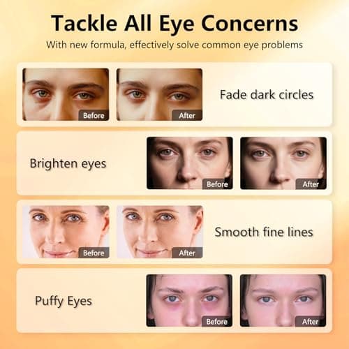 Aeryea Under Eye Patches with Vitamin C & Caffeine 30 Pairs for Dark Circles, Fine Lines and Puffiness, with Niacinamide Hydra-Gel Collagen, Skin Care for Men & Women - Thumbnail 5