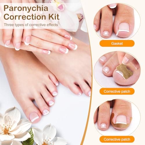 Ingrown Toenail Corrector Set with Correction Strips, Ingrown Toenail Removal Kit, Professional Ingrown Toenails Pedicure Tool Set (Silver) - Thumbnail 3