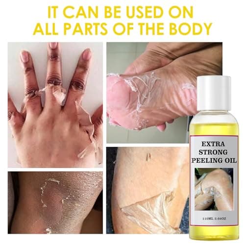 YAFUSIPE Yellow Peeling Oil for Dark Skin Strong Peel Oil Extra Strength Exfoliating Chemical Exfoliant Peels Solution at Home Body Peeling for Exfoliate Body Hand Foot Knuckle All Skin Type 3.66 OZ - Thumbnail 2