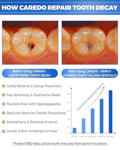 CAREDO Cavity Reversal Hydroxyapatite Toothpaste for Adults, Cavity Tooth Filler as Home Cavity Repair, Fluoride Free Reverse Cavities Treatment for Tooth Decay Repair, Remineralizing Repair 3.52OZ - Thumbnail 2