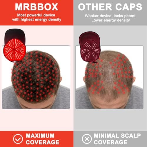 Red Light Therapy for Hair Growth,528 Total Light Emitters,Full-Scalp Coverage,Laser Hair Growth Cap,Blue - Thumbnail 6