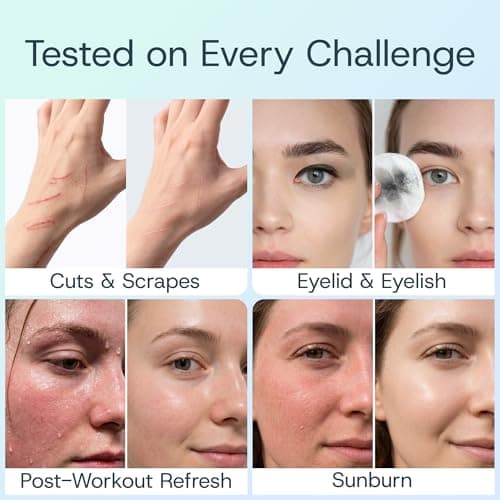 Hypochlorous Acid Spray for Face & Skin - Clinically & Dermatologist Tested HOCl Face Mist for Face, Skin, Acne, Eczema, Rash & Wound Care, Gentle & Non-Irritating for All Skin Types & Ages, 4oz - Thumbnail 3