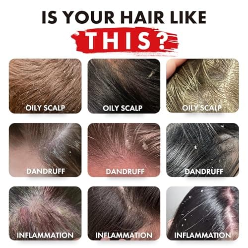 ALFHEIM Rosemary+ Purifying Shampoo – Clarifying Cleanse for Oily & Fine Hair with Rosemary, Peppermint & Jojoba Oils – Deep Scalp Refresh, Lightweight Volume – Vegan, Sulfate Free – 18 oz / 535 ml - Thumbnail 2