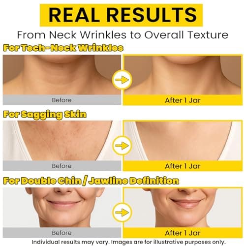 Chillihaer 8-in-1 Neck Firming Cream–Retinol & Triple Collagen Moisturizer for Neck,Face,Chest & Décolleté–Tighten, Lift&Smooth the Look of Sagging Crepey Skin, Fine Lines&Wrinkles–Women&Men,1.7 Fl Oz - Thumbnail 3