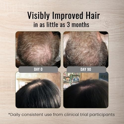 Healthy Hair Made Simple – Clinically-Proven Once Daily Hair Loss Support Tablet – Propriety Botanical Blend - Safe & Natural Supplement for Men & Women - By Skin Clinic for Hair - USA Made - Thumbnail 2