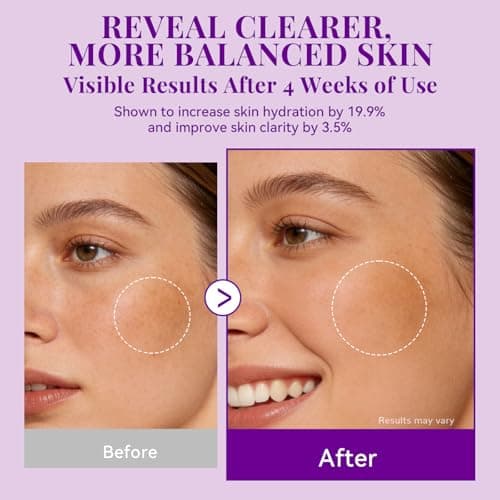 ANAI RUI Tranexamic Acid Cream with 70,000ppm Arbutin & 50,000ppm TXA, 5% Niacinamide, Dark Spot Care, Smooth & Even-Looking Skin, 1.7oz - Thumbnail 6