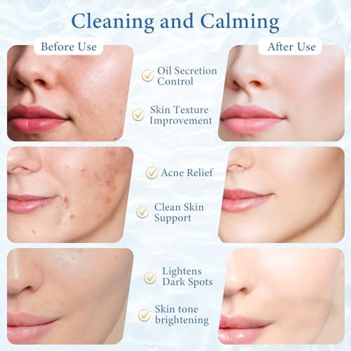 Exfoliating Toner Pads for Face & Body, Gentle for Sensitive Skin, 1% Salicylic Acid, Pore Cleansing & Smoothing, with Cica & Hyaluronic Acid, 70 Count - Thumbnail 4