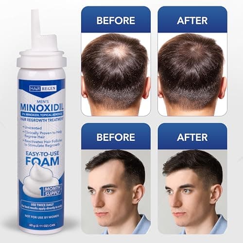 Hair Regen Minoxidil Foam for Men 5% Percent - Men's Hair Growth Treatment for Him- Topical Foaming Minoxidil for Men- Great for Hair Regrowth and Reduce Hair Loss - 6 Pack as 6 Months Supply - Thumbnail 4
