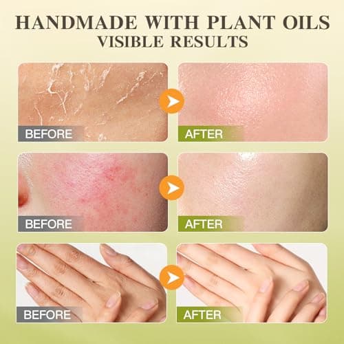 ICIKOL Organic Beef Tallow Honey Balm, Whipped Moisturizer for Face and Body, Grass-Fed Tallow Cream for All Skin Types, Orange Blossom Scent, Non-Greasy Day & Night Skincare, 5.3 oz - Thumbnail 5