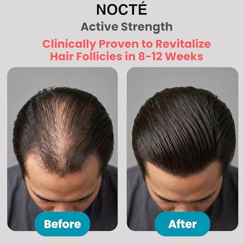 Hair Regrowth Serum Spray - Minoxidil 5% Advanced Rosemary, Biotin with Caffeine, Botanical Extract for Thicker, Fuller, Longer Hair, Reduces Hair Thinning, Hair Loss Treatment for Men & Women - 60 ML - Thumbnail 4