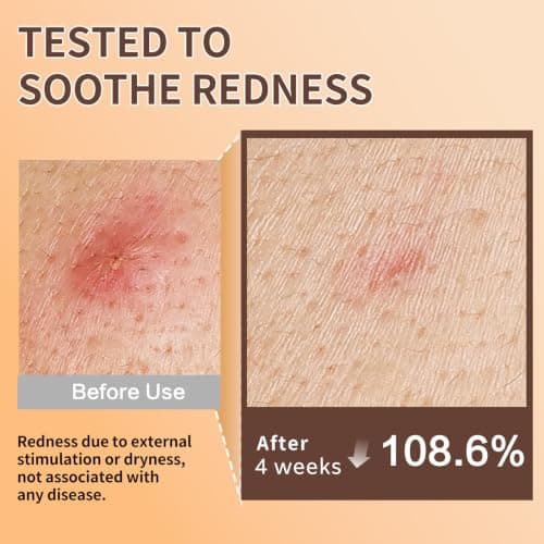 ABOTE Snail Mucin Face Serum 120ml with Pure 96% Snail Secretion Filtrate, Deep Hydration, Refreshing Skincare for All Skin Types (4.06 fl.oz) Travel Pack Size - Thumbnail 3