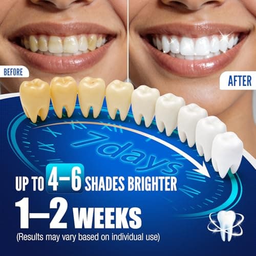 Teeth Whitening Pen Kit - 35% Carbamide Peroxide, Stain Removal, 4 Whitening Pens + 2 Remineralizing Pens, Enamel Repair, Anti-Cavity, Sensitive Teeth Care, 6 x 0.14 fl oz (Spearmint) - Thumbnail 2