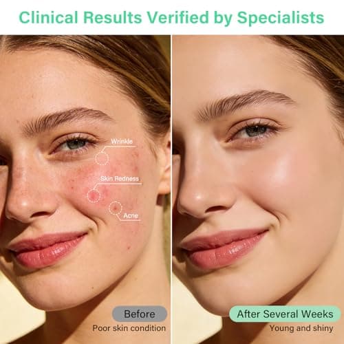 GWOWLWF LED Face Mask Light Therapy with Neck, 7-Color Skin Care Mask for Home Use, Red 630±5nm & Near Infrared 830nm, Helps Reduce Wrinkles & Inflammatory Acne（Green） - Thumbnail 3