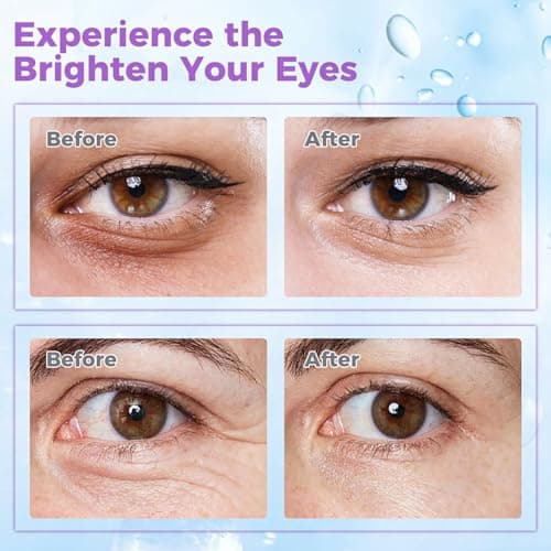 Eye Cream for Dark Circles– Revitalizing Formula with Retinol, Caffeine, Hyaluronic Acid, Peptides & Plant Extracts to Smooth Fine Lines - Thumbnail 4