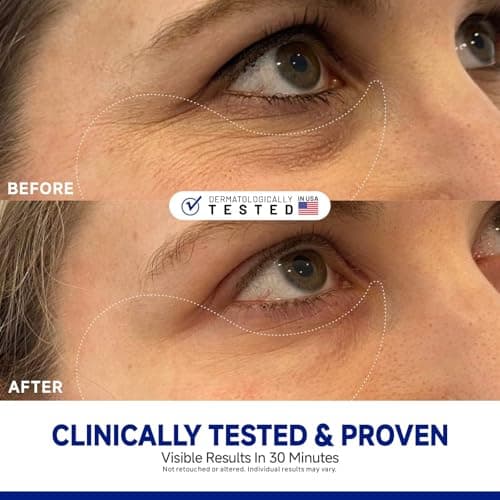 Dr Vincent Peptide Jojoba Under Eye Patches, Collagen Eye Mask Instant Reduces Dark Circles and Puffiness, 60 Firming Undereye Hydrating & Cooling for Bags Treatment, Wrinkles, Vegan, No Fragrance - Thumbnail 2