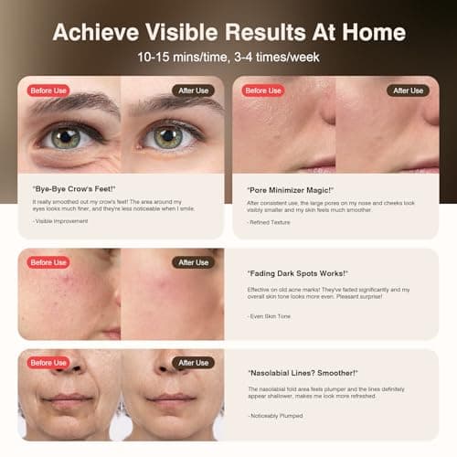 Red Light Therapy for Face, 9 Modes Wireless Face Mask Light Therapy, 850nm Infrared & Red Light Masks, 2500mAh Rechargeable, 3D Facial Fit, Light Therapy Skin Care At Home - Thumbnail 3