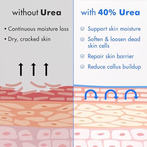 Ebanel Urea Cream 40% plus Salicylic Acid 2%, Foot Cream for Dry Cracked Heels Feet Knees Elbows Hands, Foot Dead Skin Cuticle Callus Remover Toenail Softener, Keratolytic Skin Barrier Repair - Thumbnail 5