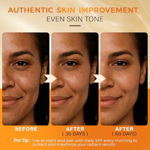 QOOQ Turmeric Kojic Acid Soap for Dark Spots Remover – Facial Cleansing Bar with Vitamin C, Retinol, Collagen, Vitamin E, Glycerin, Shea Butter & Castile Olive Oil – Soap for Women & Men (120g x 2) - Thumbnail 3