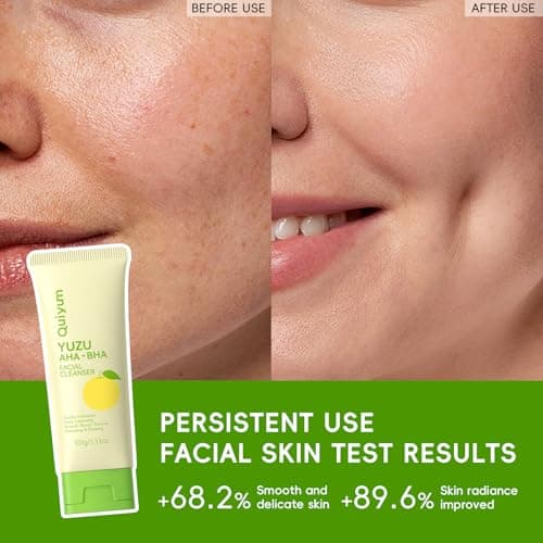 QUIYUM Yuzu AHA BHA Skincare Set for Teens & Young Women - 3.53oz Foaming Cleanser + 5 PCS Exfoliating Sheet Masks + 2.12oz Hydrating Gel Moisturizer | Gentle Exfoliation, Oil Control & Glowing Skin - Thumbnail 5