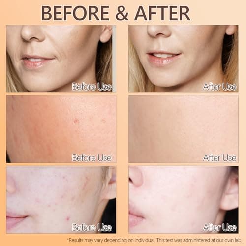 ABOTE Snail Mucin Face Serum 120ml with Pure 96% Snail Secretion Filtrate, Deep Hydration, Refreshing Skincare for All Skin Types (4.06 fl.oz) Travel Pack Size - Thumbnail 6