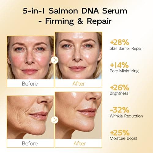 YouthVibe 0.5% PDRN Serum for Face, Anti-Aging Salmon DNA Face Serum with Hyaluronic Acid, Niacinamide & Squalane, Firming & Hydrating for Fine Lines & Wrinkles Skincare - 30ml - Thumbnail 5