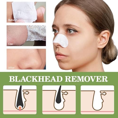 Nose Strips Blackheads Remover, Deep Cleansing Nose Plants Pore Strips Blackhead Remover Strips with Salicylic Acid, Black Head Remover Strips Peel off Mask Nose Strip Skincare for All Skin - Thumbnail 2