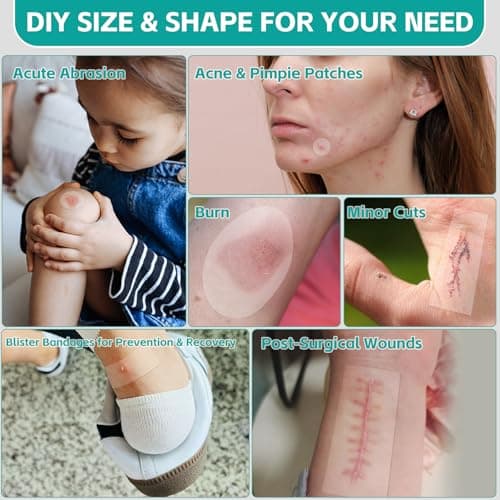 New Version Hydrocolloid Roll,2in*16ft Hydrocolloid Bandages for Wound Care,Medical-Grade Hydrocolloid Patch Bandages with Self-Adhesive, Flexible & Waterproof DIY Size & Shape (16FT) - Thumbnail 4