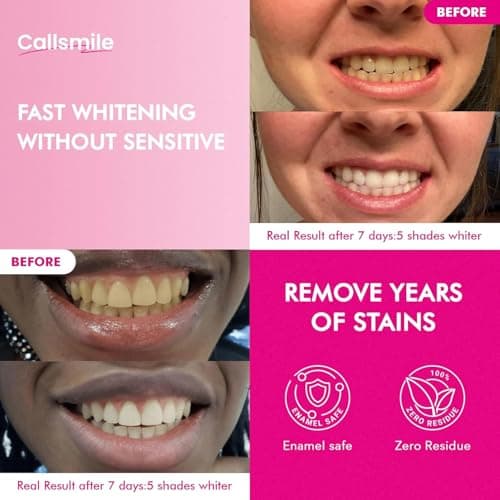 CALLSMILE Whitening Strips for Teeth Sensitive: 64 Strips Gentle Teeth Whitening Strips Enamel Safe Non-Slip Dry Strip Technology Residue Free Daily Oral Care, Mint - Thumbnail 2