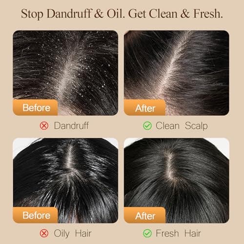 Dear Irean Shampoo and Conditioner Set, Anti Dandruff Oil Control Repair Shampoo and Conditioner, Sulfate Free with Argan Oil for Women, Hair Gloss Treatment for Oily, Dry, Damaged, Curly Hair 30.4 Oz - Thumbnail 2