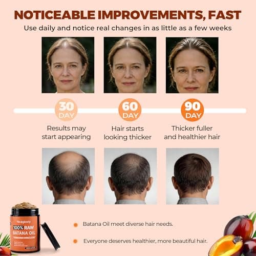 Neoglowly Batana Oil for Hair Growth, 100% Pure & Organic from Honduras, Wild Growth Hair Oil, Enhances Thickness & Strengthens Strands, Suitable for All Hair Types (8.8 oz) - Thumbnail 3