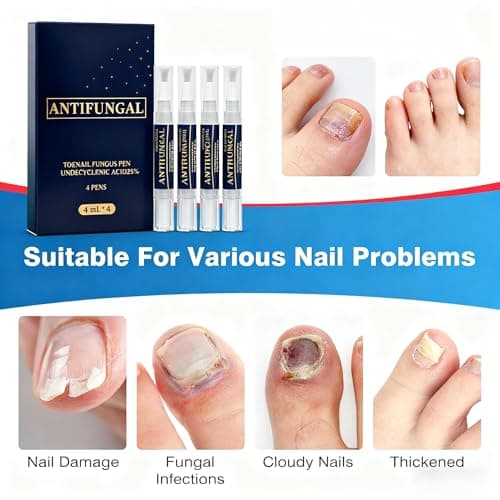 YLTNEUQER Toenail Fungi Treatment Extra Strength & Fungi Nail Pen - 4Pcs Nail Repair Pen, Targeted Solution for Nail Health Concerns (Athletes Ideal), 4ml/0.14FLOZ - Thumbnail 3