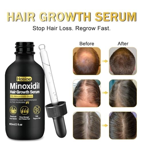 5% Minoxidil Hair Growth Serum for Men and Women Hair Regrowth Treatment,Topical Minoxidil for Beard Growth(3Packs) - Thumbnail 2