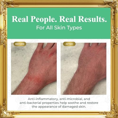 Pure Truth Whipped Tallow and Honey Balm (Citrus), Beef Tallow for Skin Care, Grass Fed + Finished Tallow Moisturizer Cream for Face & Body w/Organic Honey, Aloe Vera, Jojoba Oil - Men Women 3.25oz - Thumbnail 5