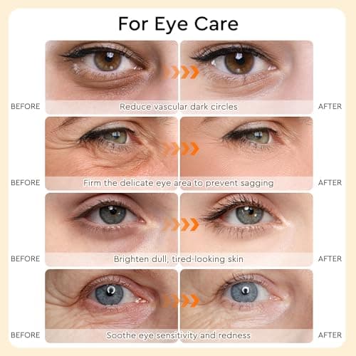 Under Eye Patches For Puffy Eyes and Dark Circles, Soothing Hydrating Eye Mask with Calendula, Green Tea, Retinol, Hyaluronic Acid Eye Pads Skin Care Bridesmaid Gifts for Girls Women (30 Pairs) - Thumbnail 5