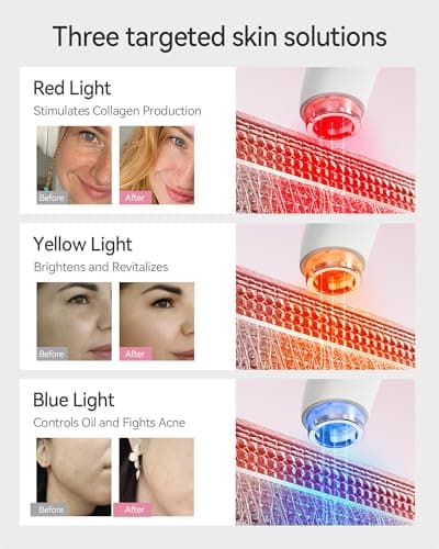 FliKEZE Red Light Therapy Device for Face and Neck, 3-in-1 Microcurrent & Vacuum Facial Massager, Skin Tightening, Firming and Anti-Aging Skincare Tool (White) - Thumbnail 5