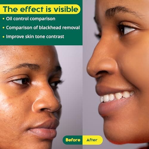 Kojic Acid and Turmeric Cleansing Pads - 100 Pads | Enriched with Ginger Root Oil & Amino Acids | for Face & Body - 100pcs - Thumbnail 3